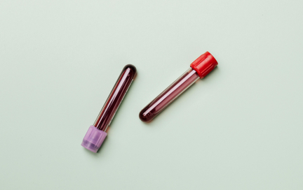 Фитнес и кровообращение: что нужно знать про тромбоциты