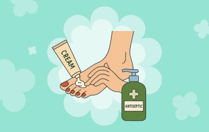 Грибок ногтей: первые признаки, которые нельзя игнорировать